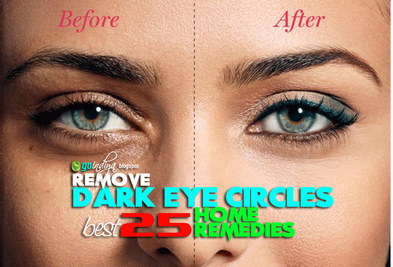 Corrector Makeup Puffy Eyes Dark Circles Home Remedies