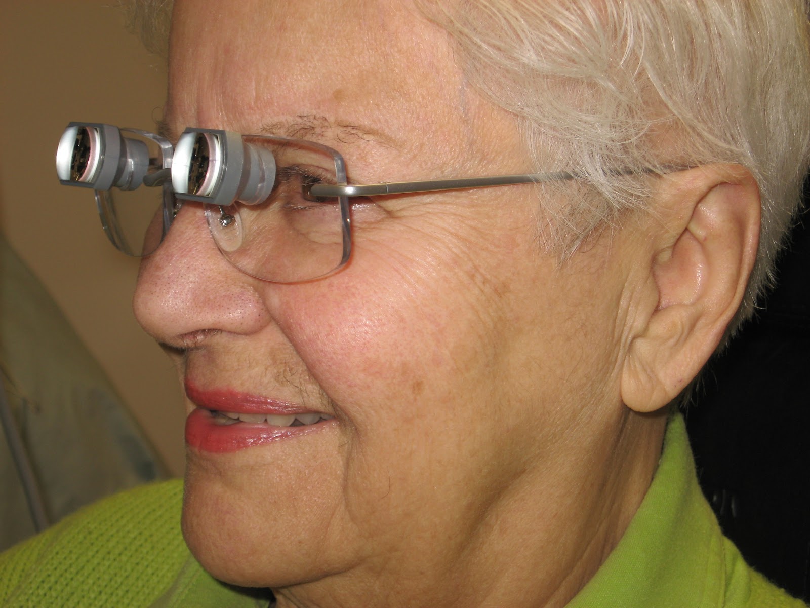 Low Vision Eyeglasses First Connecticut Implanted Telescope Option for