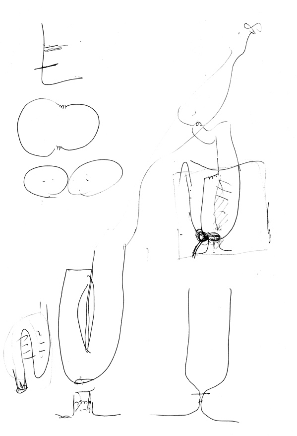 The knife you see Ulcerative Colitis, Colectomy & Beyond