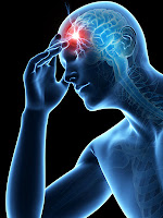Penyakit Stroke Penyakit Stroke, obat herbal stroke, icp capsule obat stroke