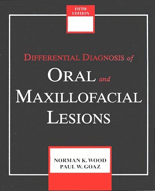 Differential Diagnosis Of Oral Lesions 20