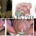 Obat Liang Vagina Keluar Nanah Bau thumbnail