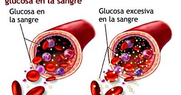 ¡Ayúdate!: Remedios naturales para controlar la glucosa en ¡Ayúdate!: Remedios naturales para controlar la glucosa en