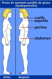 Formula para calcular porcentaje de perdida de peso Hits intensidad formula para calcular porcentaje de perdida de peso volver dibujar