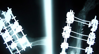 osteogenesis debil elongacion fijacion externa perro