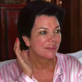 Kris Jenner on Kris Jenner S Huge Trout Pout Katerina Wilhelmina Bloggers