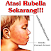 Cara Ampuh Mengobati Rubella Atau Campak Jerman