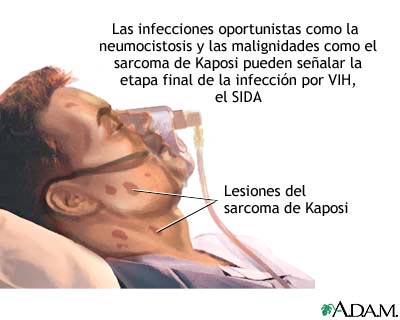 El aumento del miembro viril en amerike