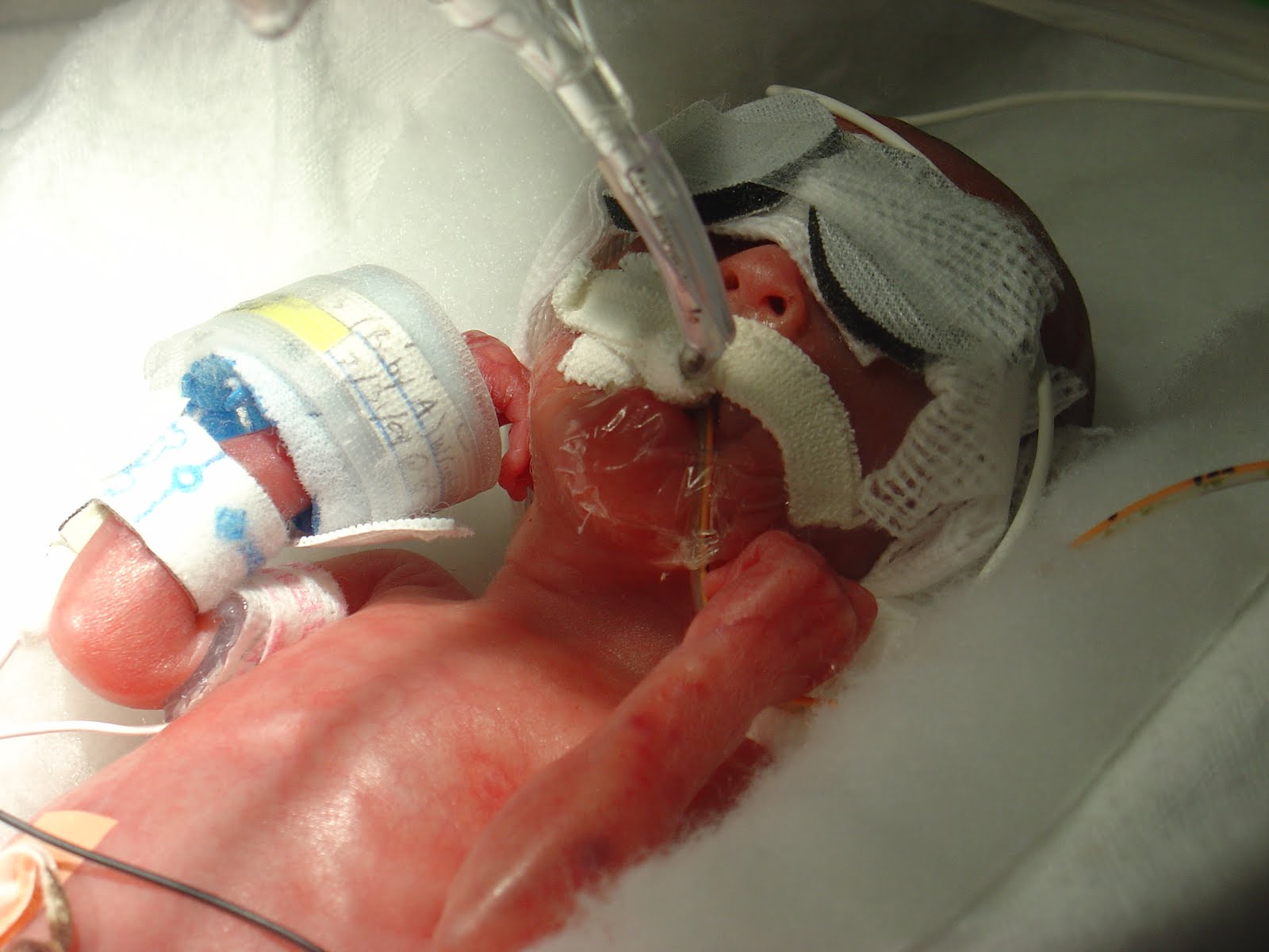 Micro Preemie Babies