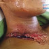 nyaris putus kepala