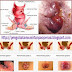 Pengobatan Wasir Ardium Ampuh di Apotik Herbal thumbnail