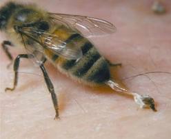 Gambar Terapi Sengat Lebah