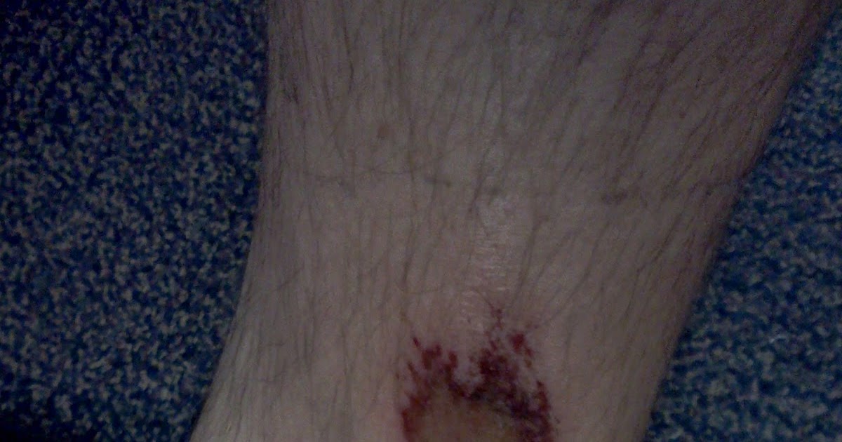 Triathlon Training Daddy Ruckus rope burn, www.RevGym.co oh my!