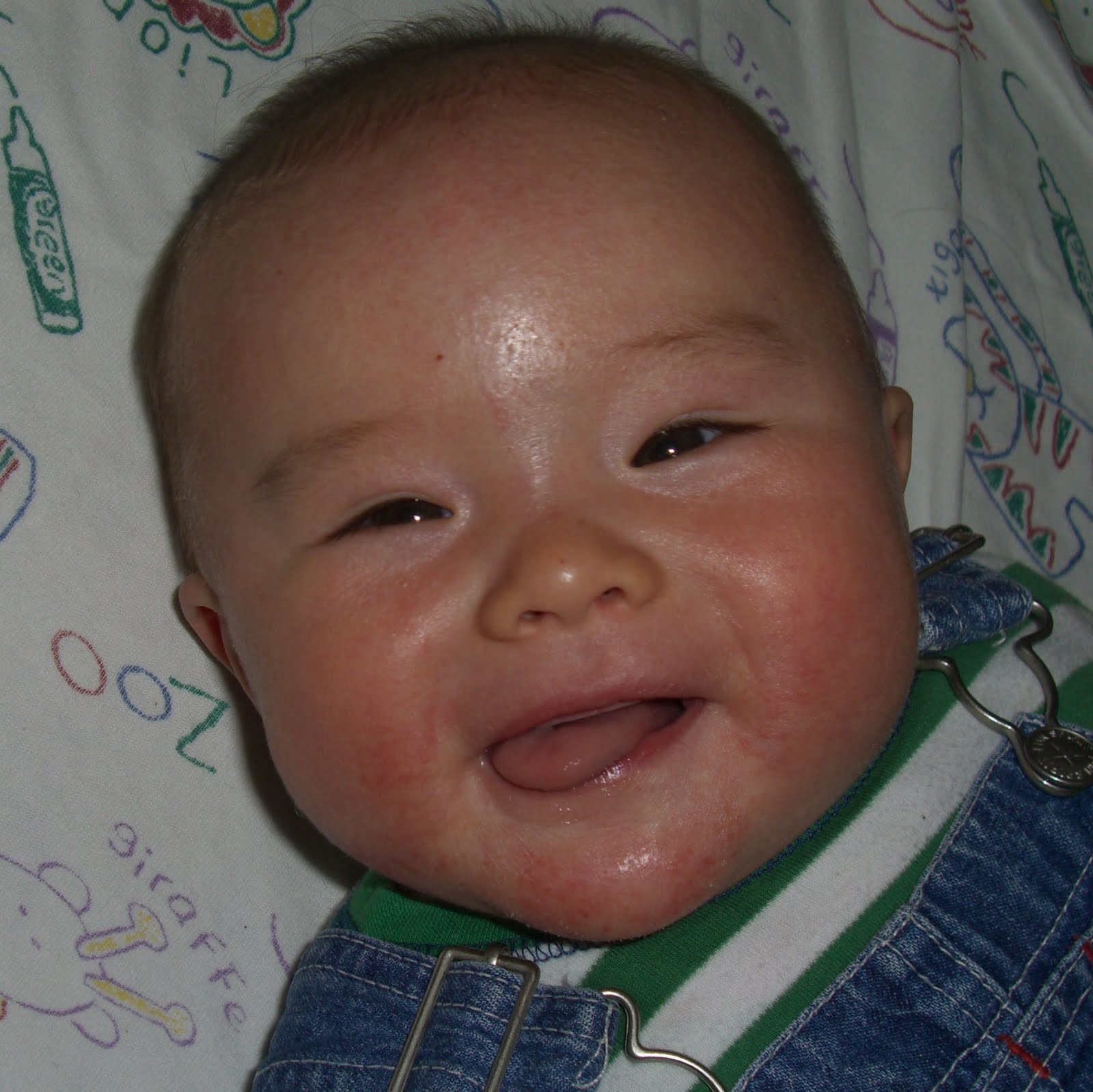 Life as a Housewife and Mum Managing Eczema in our Baby Boy