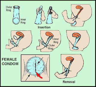 How to condom a wear with diagram How to condom a wear with diagram