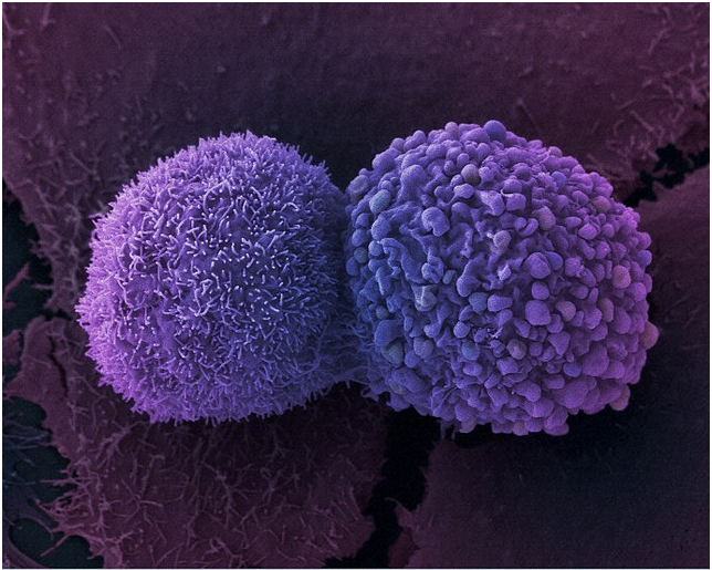 esophageal cancer research paper esophageal cancer research paper
