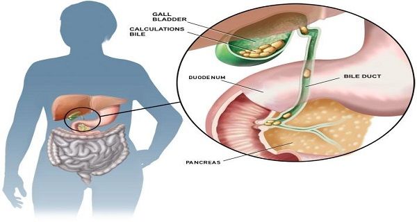 The Secret of Chinese Medicine Finally Discovered: This Recipe Successfully Removes Gallstones The Secret of Chinese Medicine Finally Discovered: