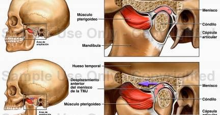 Duele la espalda a la izquierda al niño