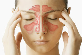 Sinusi - kako ih izlečiti na prirodan način Webmd_composite_image_of_sinuses
