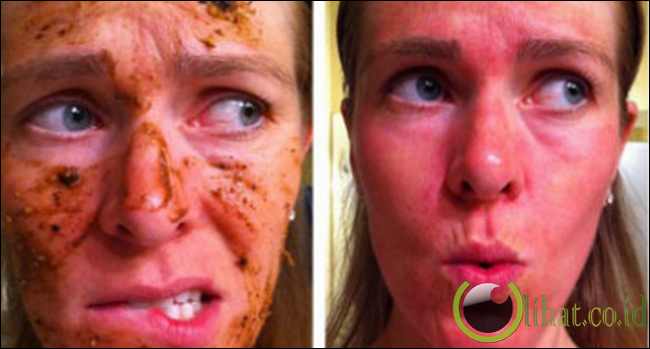 Plasenta Manusia Plasenta Manusia