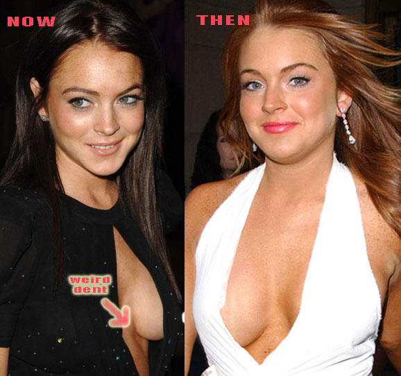 Lindsay Lohan Boob Job 77