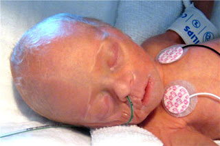 Alexander Identical Twin to Maximilian