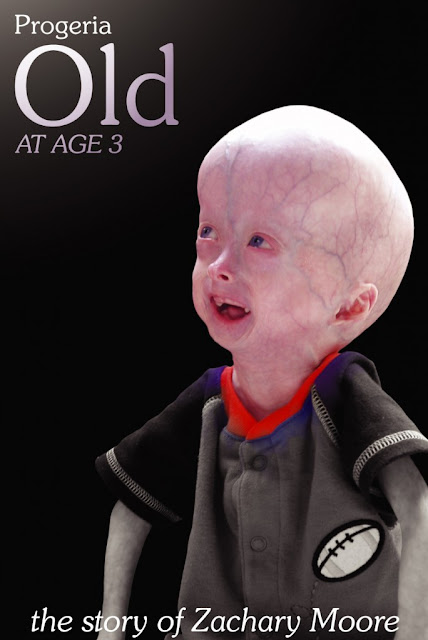 See and Know: Weirdest Medical Conditions