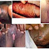 Jual Obat Mujarab Sipilis thumbnail