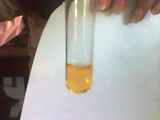 ILhanhy Trombosit Uji Urine ILhanhy Trombosit Uji Urine