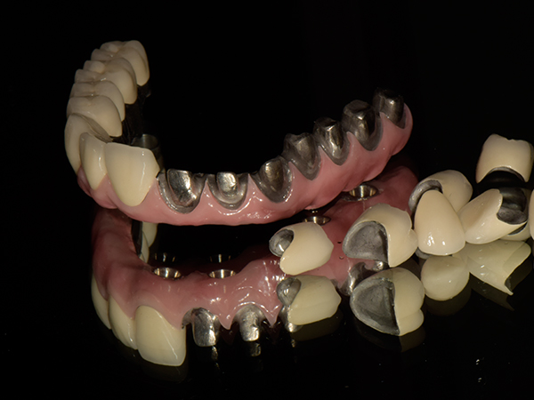 Dental Implant Cases China