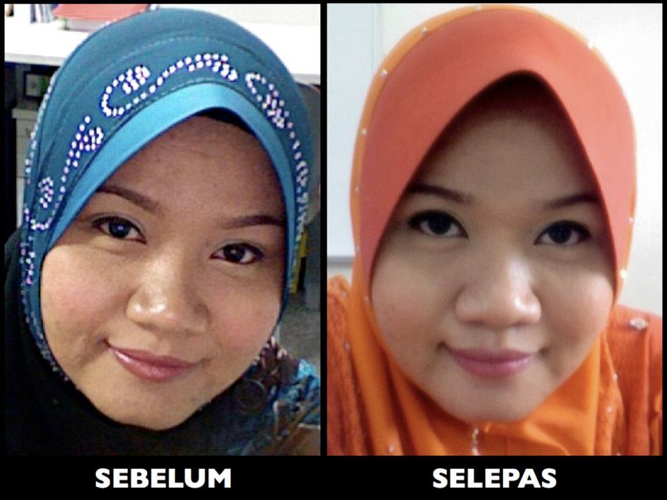 Ct Hajar Kedai Baju: AURA MAYA SKIN CARE