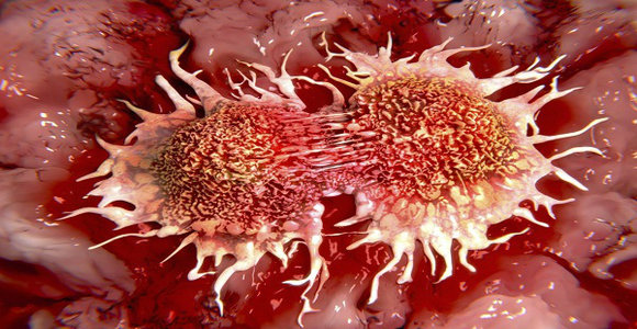 WHY IS THIS HIDDEN FROM THE PUBLIC: Top 10 Causes of Cancer That We Use Daily! WHY IS THIS HIDDEN FROM THE PUBLIC: Top 10 Causes of Cancer That We Use Daily!