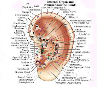 Acupuncture And Arthritis