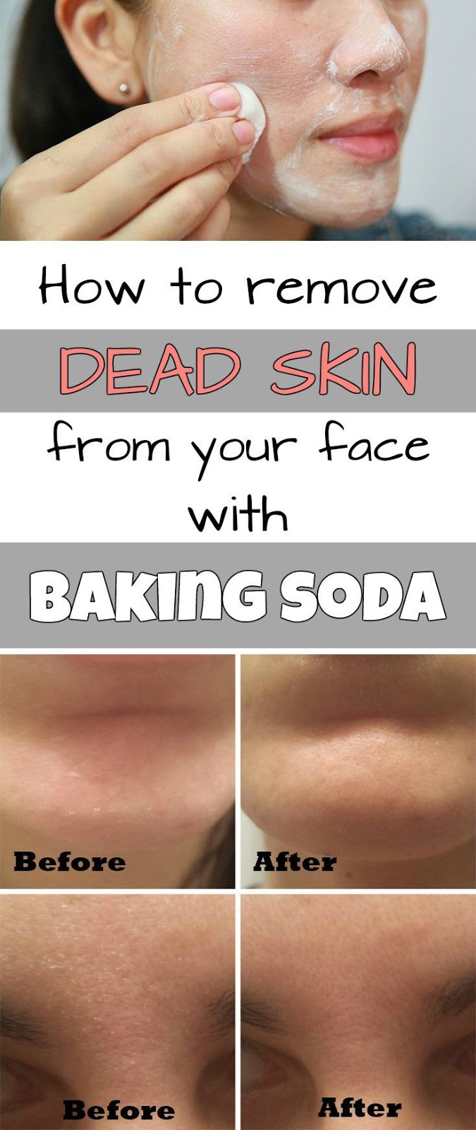 How to remove dead skin from your face with baking soda All Remedies