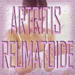 Nuestra página en Facebook: Artritis Reumatoide