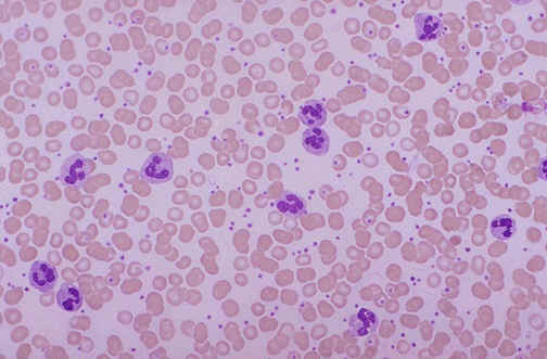 Wbc Blood