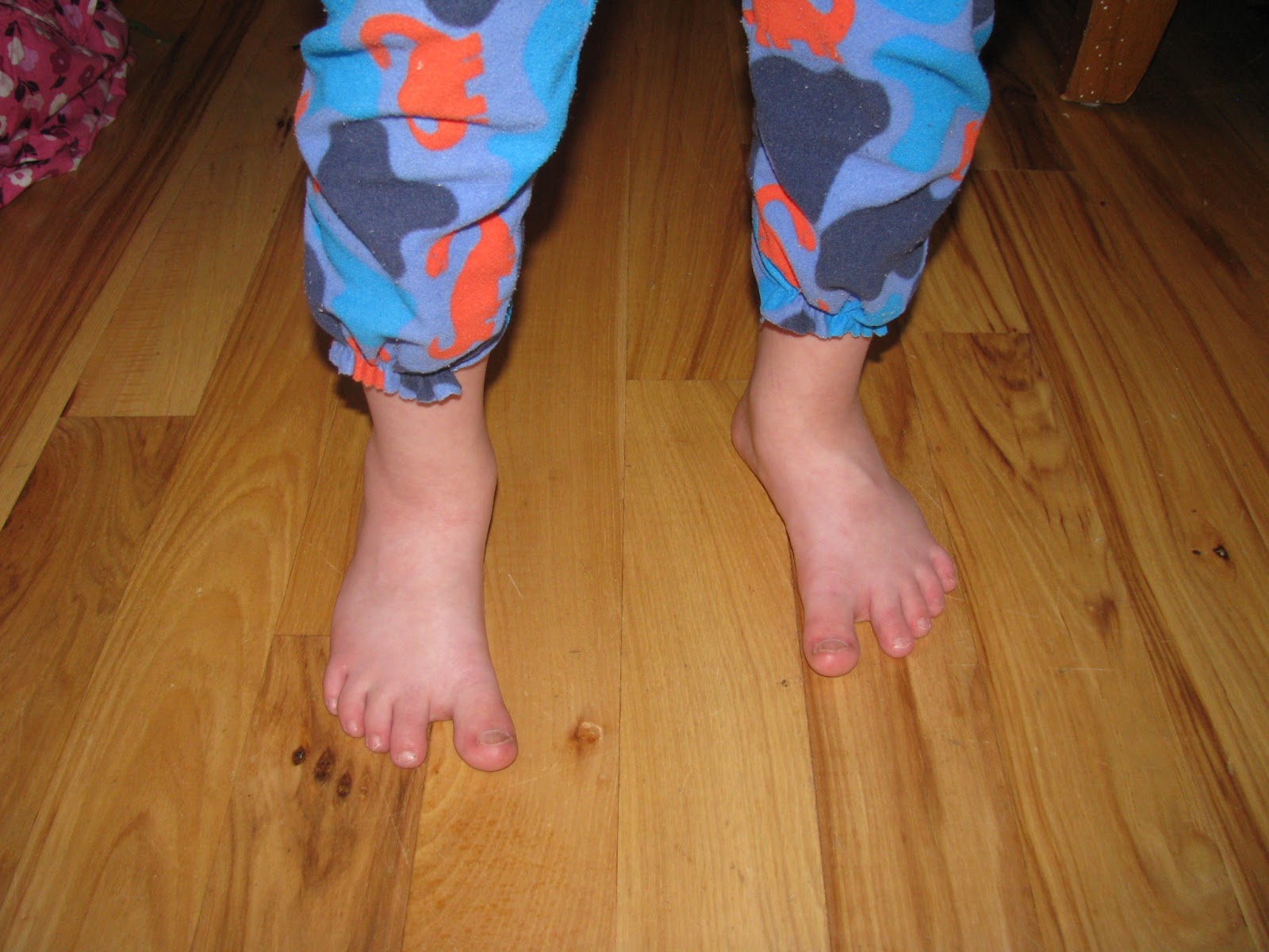 CAMP HOMESCHOOL Two Clothing Tips for Kids with Down Syndrome