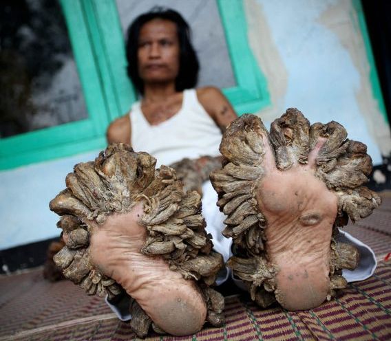 horn_tree_feet.jpg