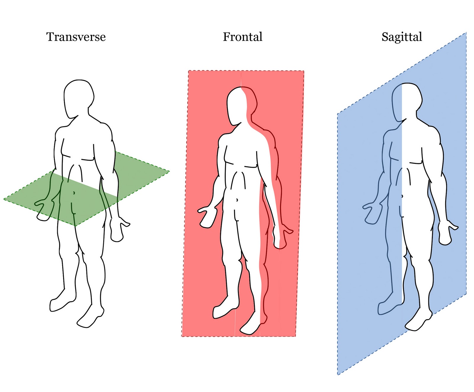 Coronal Frontal Plane