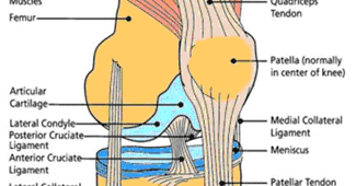 My Bilateral Total Knee Replacement And Addiction Experiences: OA STILL