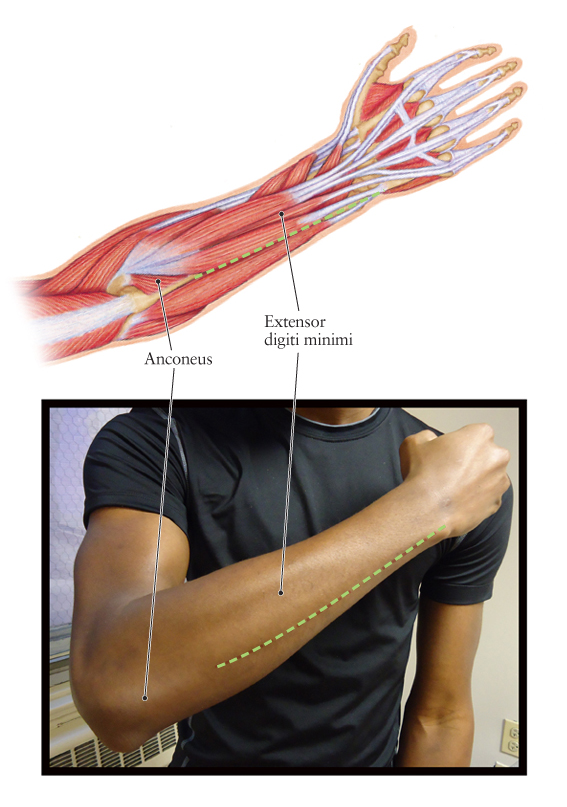 Human Anatomy for the Artist: The Dorsal Forearm, Part 2: Which Side