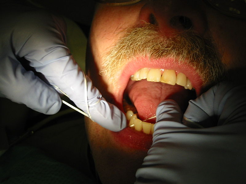 Flossing Of Teeth