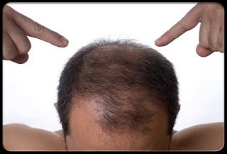 Tips To Stop Hair Falling For Men Tips To Stop Hair Falling For Men