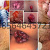 Obat Nyeri Wasir di Anus Pria dan Wanita thumbnail