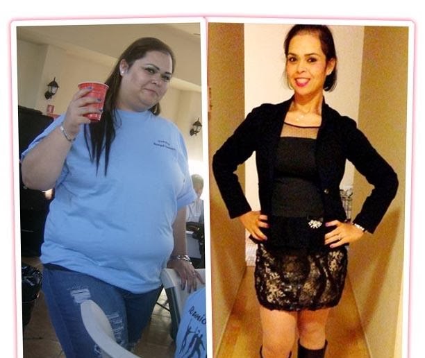 List 95+ Pictures Orlistat Before And After Pictures Updated