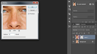 Cara Menghilangkan Jerawat dengan Photoshop Cara Menghilangkan Jerawat dengan Photoshop