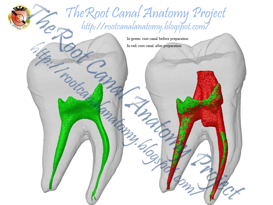 The Root Canal Anatomy Project Conservative Endodontic Access