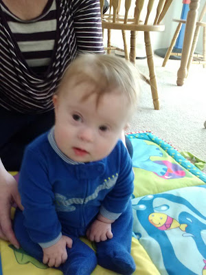 Physical Therapy for Down Syndrome Physical Therapy for Down Syndrome