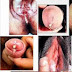 Harga Obat Gonore Asli Herbal Alami thumbnail