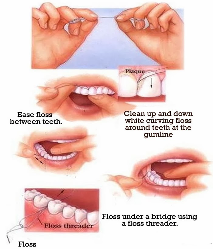 Dental FLOSS